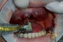 Unidad de Implantologa Avanzada y Esttica Dental - Dr. Rigal